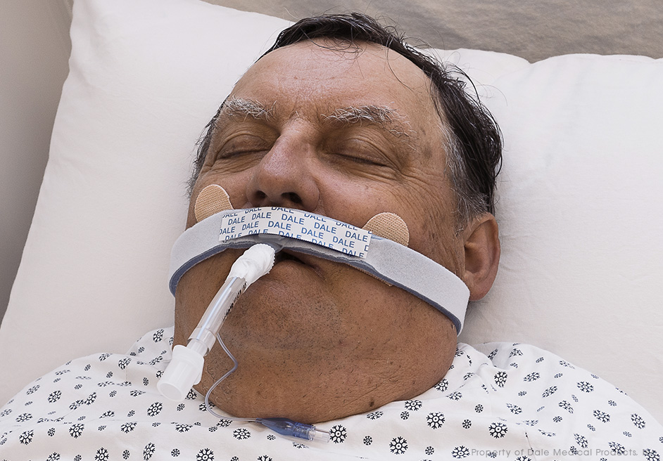 Dale 280 Breezelock Endotracheal tubeholder