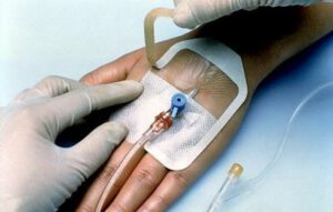 3M 1633IV Tegaderm 7x8cm, steriel